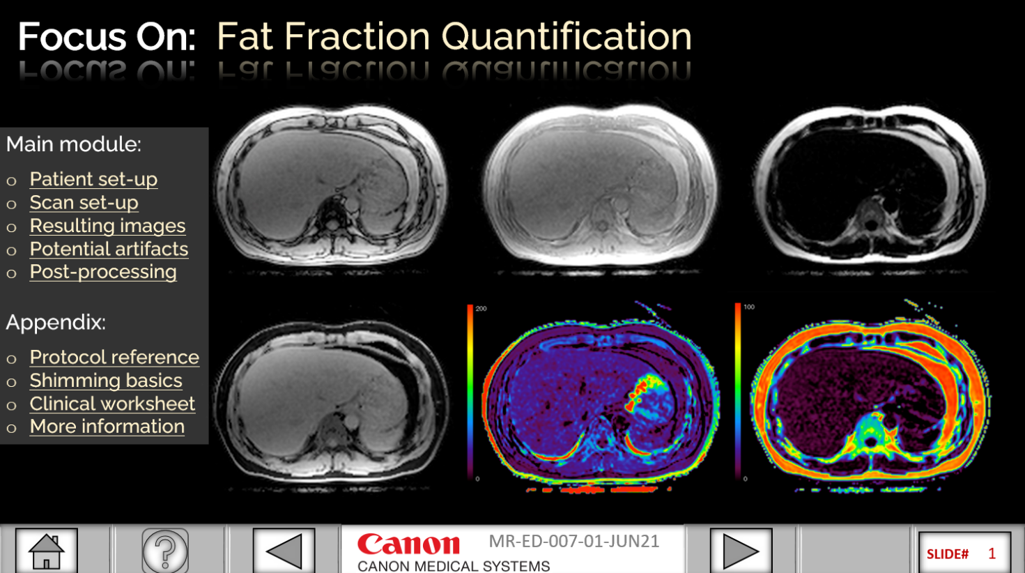Canon Medical Academy - Fat Fraction Quantification