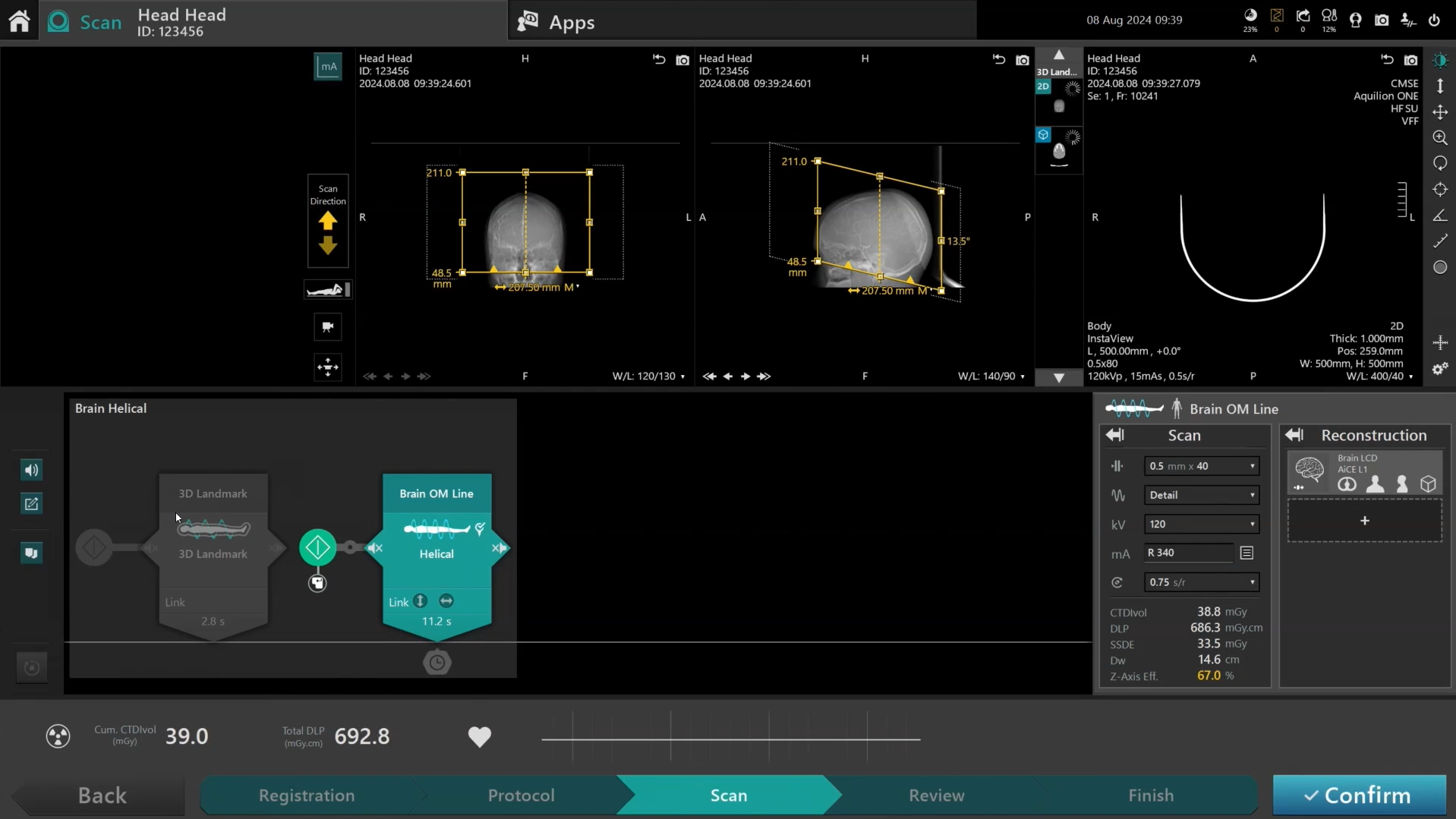 Canon Medical Academy - INSTINX: Brain Scanning