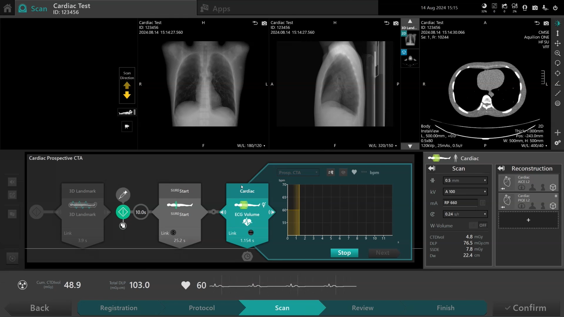 Canon Medical Academy - INSTINX: Cardiac Scanning