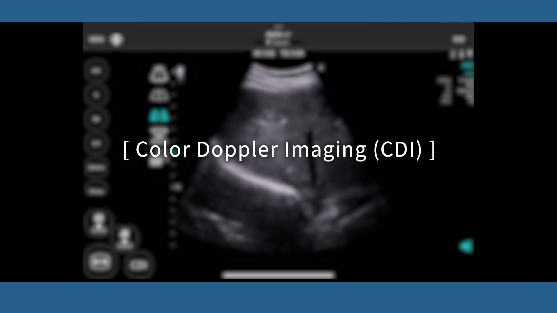 Canon Medical Academy - Aplio Air | Section 2: Basic Operation | Color ...